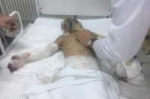 Мать избитой в Ингушетии девочки хочет вернуть ее себе, заявила омбудсмен